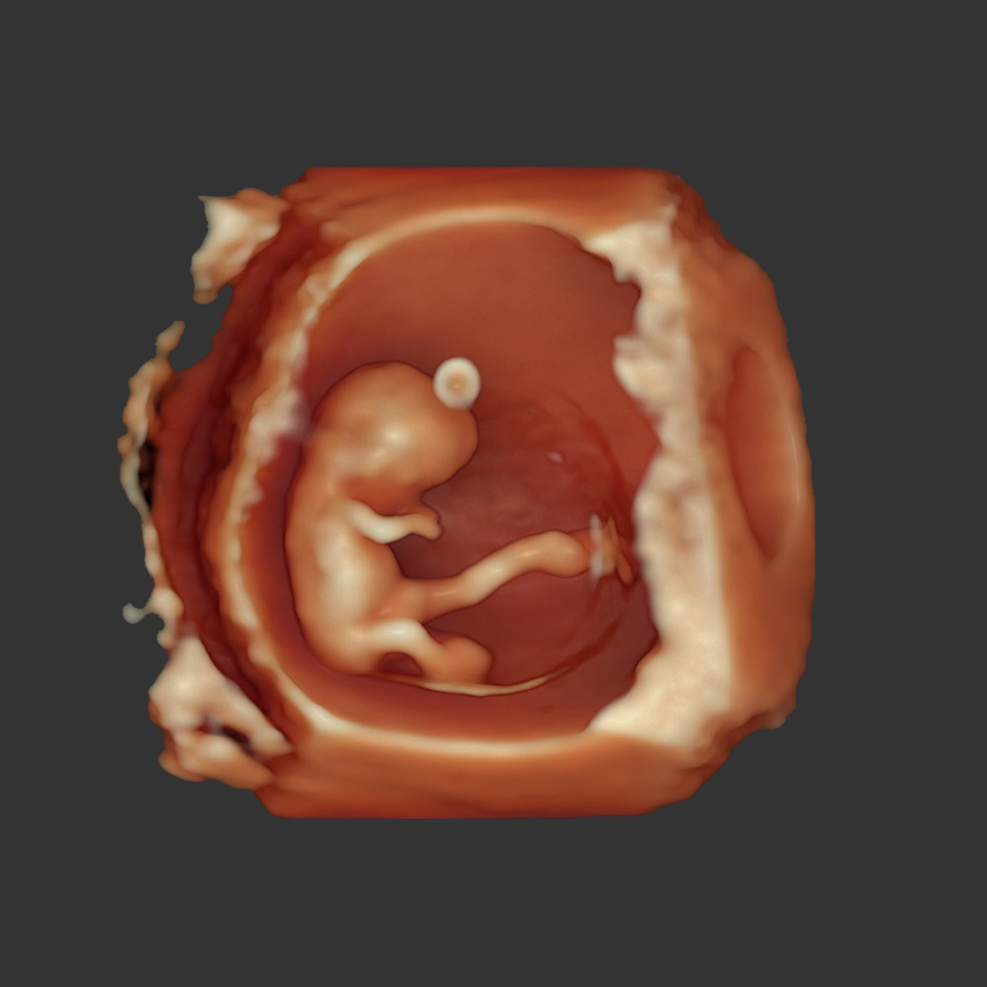 medicina-fetal